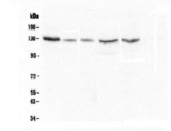 Anti-CASR Antibody Picoband® (monoclonal, 11E9)