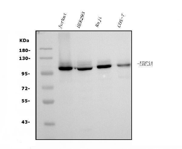 Anti-UBE3A Picoband® Antibody (monoclonal, 3F13)