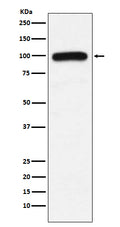 Western blot analysis of UBE3A expression in K562 cell lysate.