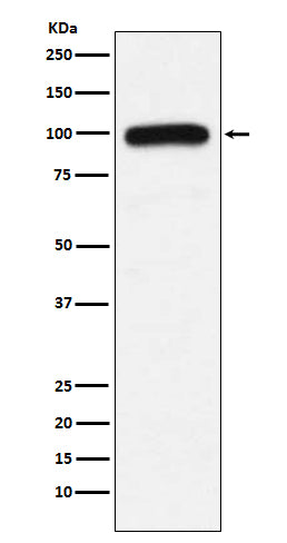 Western blot analysis of UBE3A expression in K562 cell lysate.