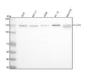 Anti-Phospho-ULK1 (S556) Rabbit Monoclonal Antibody