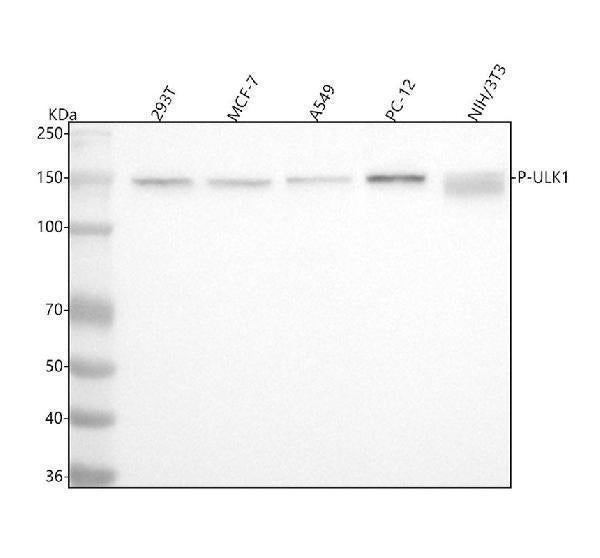 Anti-Phospho-ULK1 (S556) Rabbit Monoclonal Antibody
