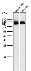 All lanes use the Antibody at 1:5K dilution for 1 hour at room temperature.