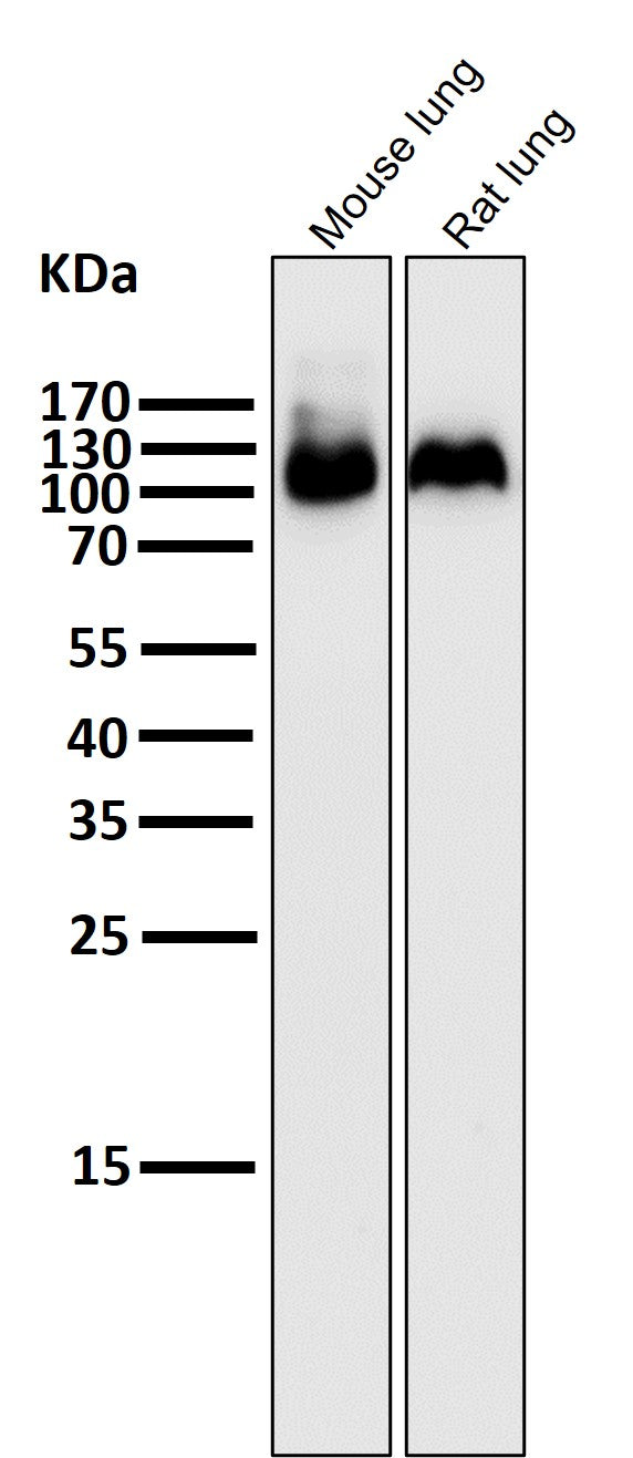 All lanes use the Antibody at 1:5K dilution for 1 hour at room temperature.