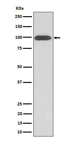 Western blot analysis of Integrin beta 3 / CD61 expression in U-87 MG cell lysate.