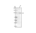 Anti-CD26/DPP4 Rabbit Monoclonal Antibody