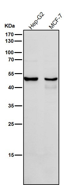 All lanes use the Antibody at 1:1K dilution for 1 hour at room temperature.