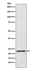 Western blot analysis of Prolactin expression in Human fetal pituitary lysate.