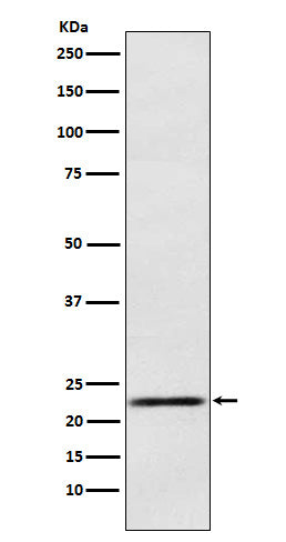 Western blot analysis of Prolactin expression in Human fetal pituitary lysate.