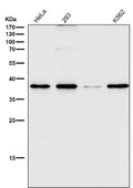 All lanes use the Antibody at 1:2K dilution for 1 hour at room temperature.