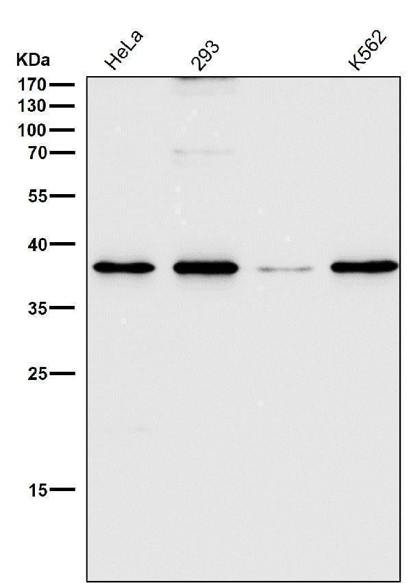 All lanes use the Antibody at 1:2K dilution for 1 hour at room temperature.