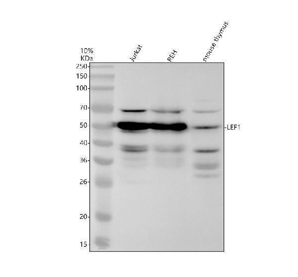 Anti-LEF1 Rabbit Monoclonal Antibody
