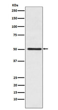 Western blot analysis of Cytochrome P450 17A1 expression in Jurkat cell lysate.
