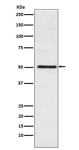 Western blot analysis of Cytochrome P450 17A1 expression in Jurkat cell lysate.