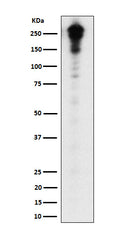 Western blot analysis of Desmoplakin expression in A431 cell lysate.