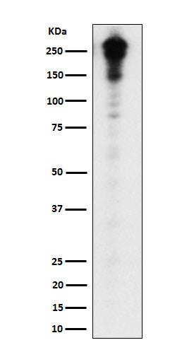 Western blot analysis of Desmoplakin expression in A431 cell lysate.