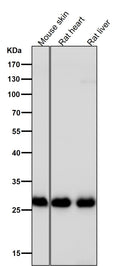 Anti-Galectin 3 LGALS3 Rabbit Monoclonal Antibody