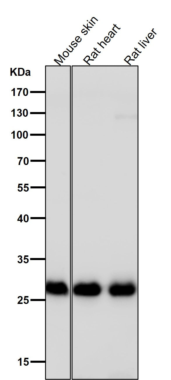 Anti-Galectin 3 LGALS3 Rabbit Monoclonal Antibody