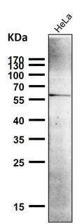 All lanes use the Antibody at 1:6K dilution for 1 hour at room temperature.