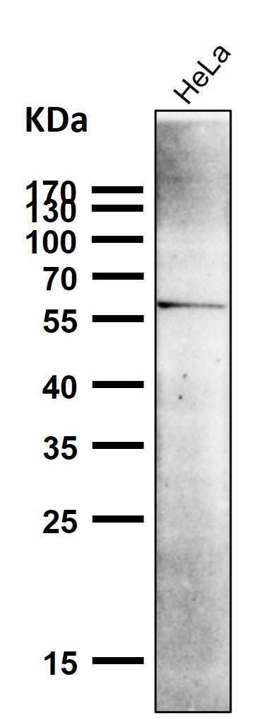 All lanes use the Antibody at 1:6K dilution for 1 hour at room temperature.