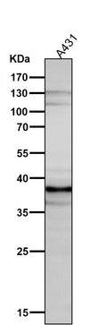 All lanes use the Antibody at 1:5K dilution for 1 hour at room temperature.