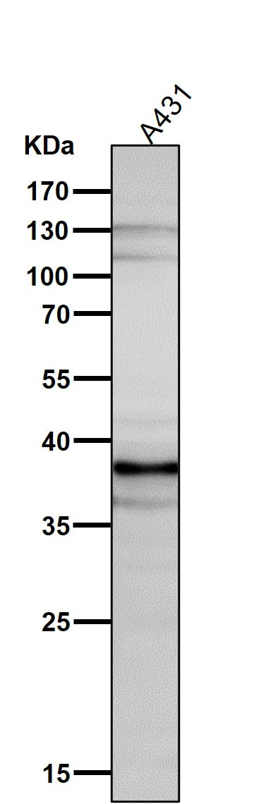 All lanes use the Antibody at 1:5K dilution for 1 hour at room temperature.