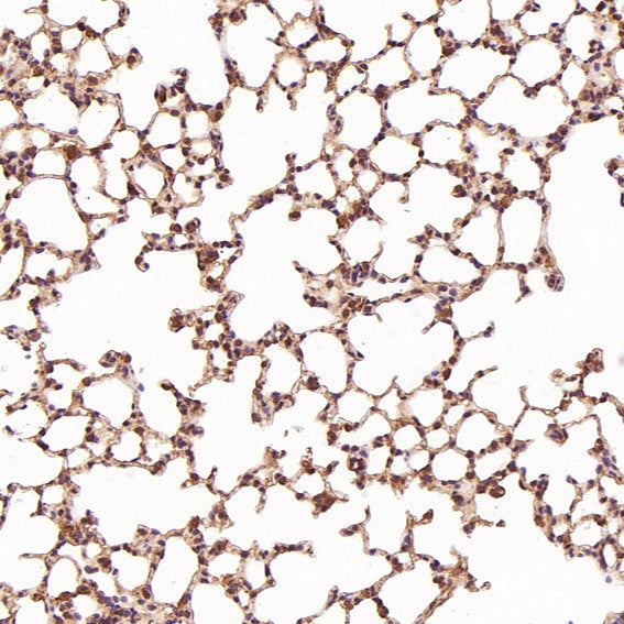 Immunohistochemical analysis of paraffin-embedded Rat liver, using the Antibody at 1:200 dilution.