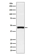 Western blot analysis of Pentraxin 3 expression in HUVEC cell lysate.