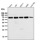 All lanes use the Antibody at 1:1K dilution for 1 hour at room temperature.