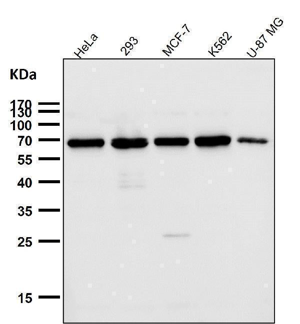 All lanes use the Antibody at 1:1K dilution for 1 hour at room temperature.
