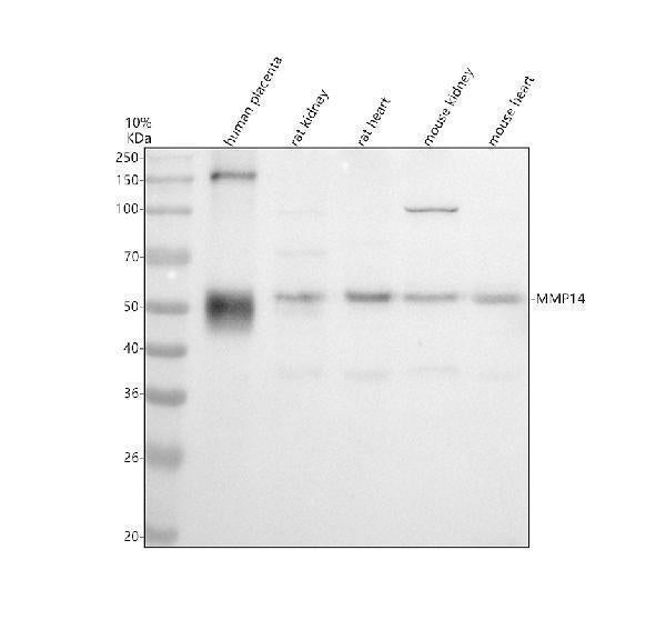 Anti-MMP14/Mt1 Mmp Rabbit Monoclonal Antibody