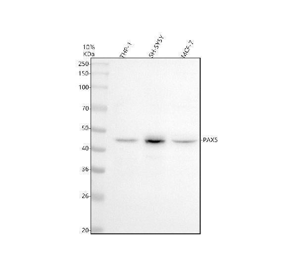 Anti-PAX5/Bsap Rabbit Monoclonal Antibody