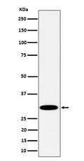 Western blot analysis of TPMT expression in Jurkat cell lysate.