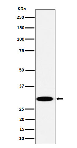 Western blot analysis of TPMT expression in Jurkat cell lysate.