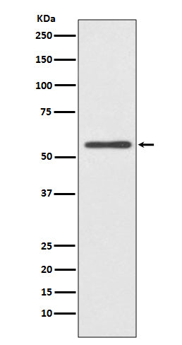 Anti-CYP2E1 Rabbit Monoclonal Antibody