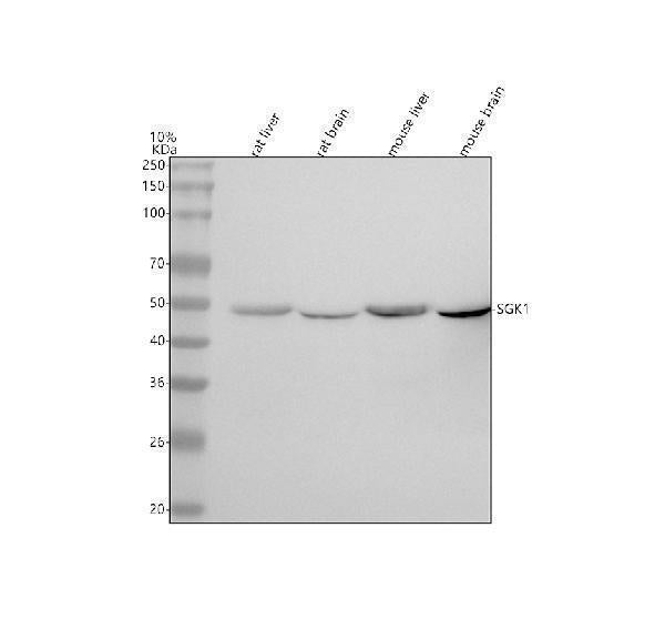 Anti-SGK1/Sgk Rabbit Monoclonal Antibody