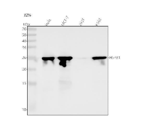Anti-Hsp27 HSPB1 Rabbit Monoclonal Antibody