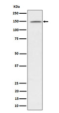 Western blot analysis of phospho-Phospholipase C gamma 1/PLC-gamma-1 (Y1253) expression in Jurkat treated with Pervanadate lysate.