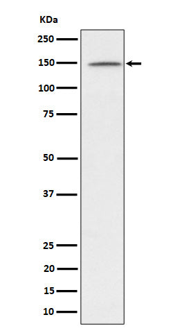 Western blot analysis of phospho-Phospholipase C gamma 1/PLC-gamma-1 (Y1253) expression in Jurkat treated with Pervanadate lysate.
