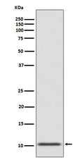 Western blot analysis of GLP1 expression in human fetal pancreas lysate.