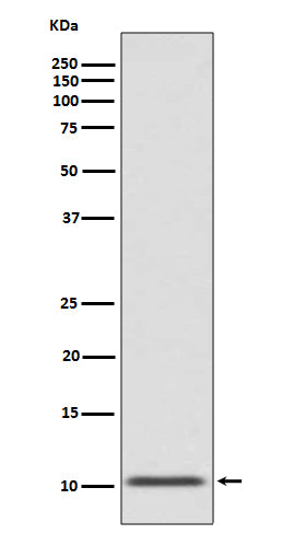 Western blot analysis of GLP1 expression in human fetal pancreas lysate.