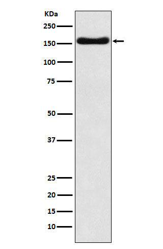 Western blot analysis of ATP7b expression in HepG2 cell lysate.
