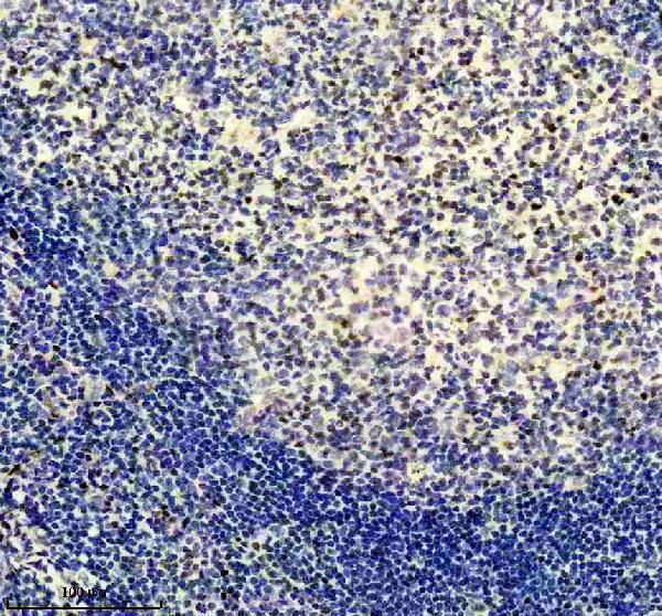 Anti-Egr1 Monoclonal Antibody
