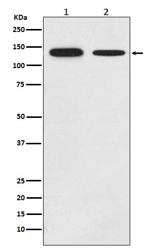 Western blot analysis of Growth hormone receptor expression in (1) MCF-7 cell lysate; (2) Mouse brain lysate.