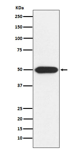 Western blot analysis of Protein Kinase A regulatory subunit I alpha expression in U-87MG cell lysate.