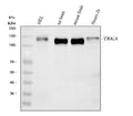 Anti-TrkA NTRK1 Rabbit Monoclonal Antibody