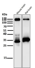 All lanes use the Antibody at 1:2K dilution for 1 hour at room temperature.