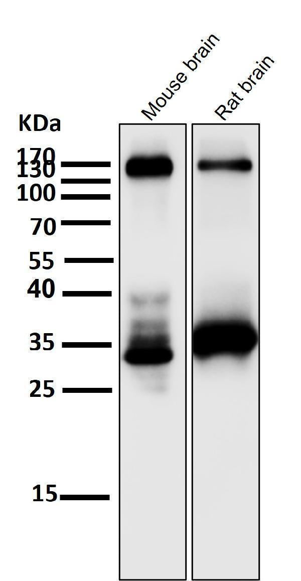All lanes use the Antibody at 1:2K dilution for 1 hour at room temperature.