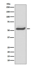 Anti-SERPINA1/Alpha 1 Antitrypsin Rabbit Monoclonal Antibody