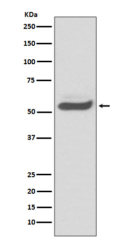 Anti-SERPINA1/Alpha 1 Antitrypsin Rabbit Monoclonal Antibody